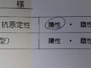 初の新型コロナウイルス感染(ちょっと前のお話)